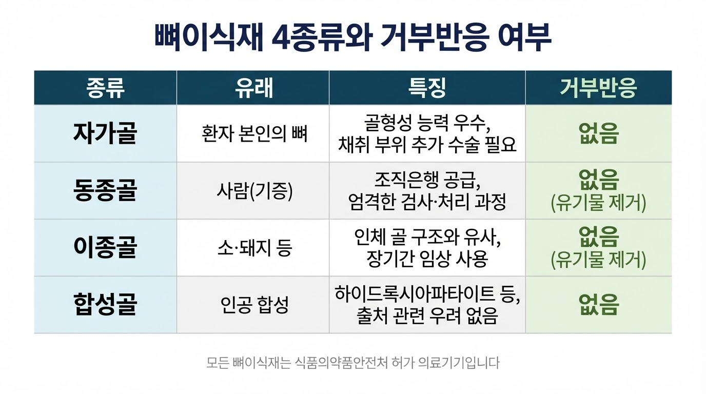 뼈이식재의 종류4가지와 거부반응 여부
