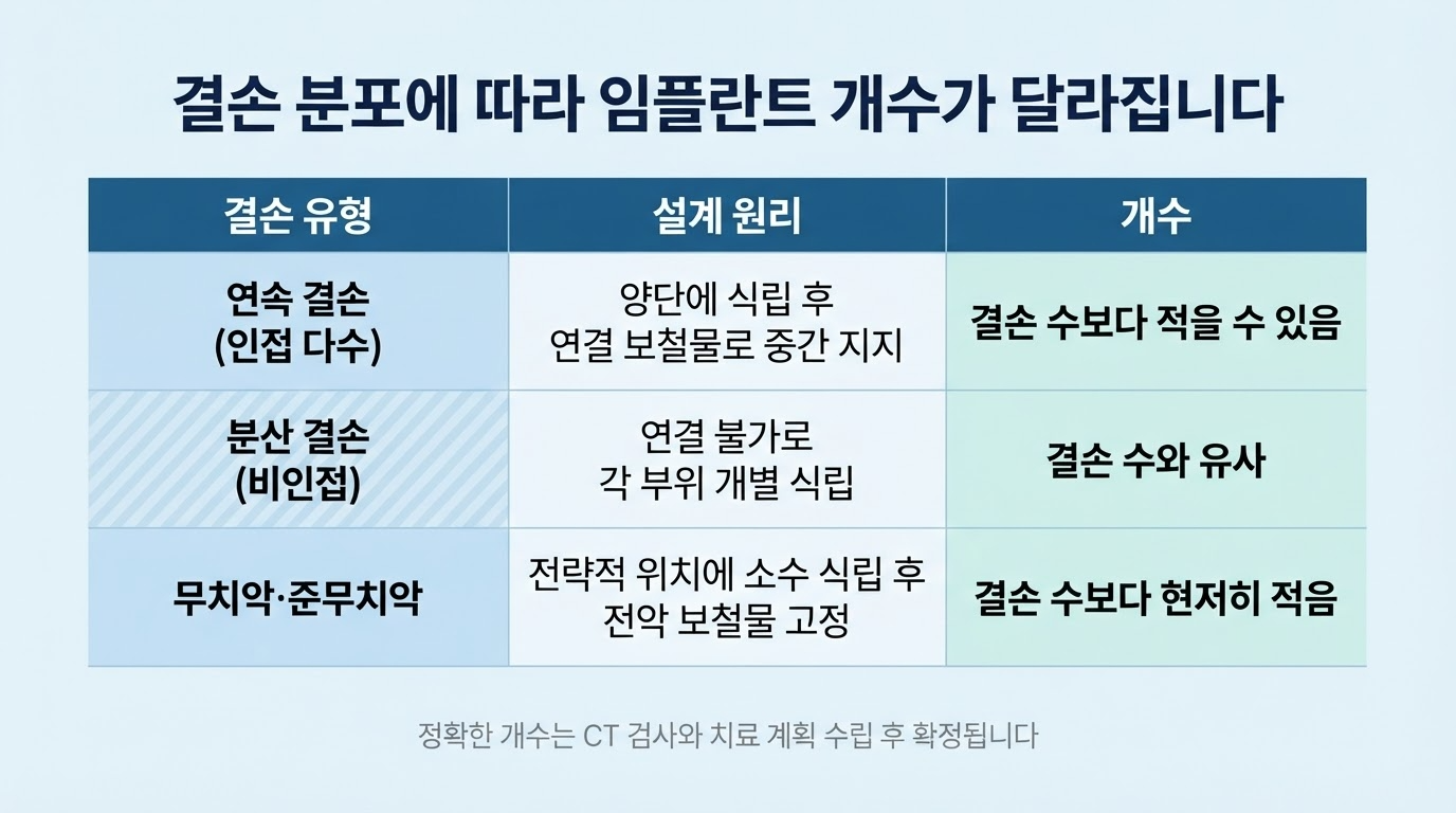 치아 여러 개 상실시, 임플란트 개수는 몇 개나 필요할까?