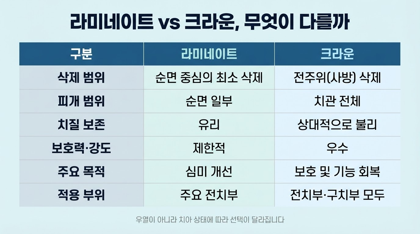 라미네이트와 크라운 차이 — 선택 기준 정리