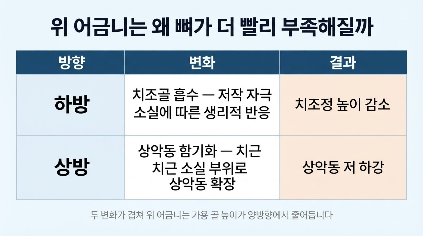 상악의 뼈가 더 빨리 부족해지는 원인