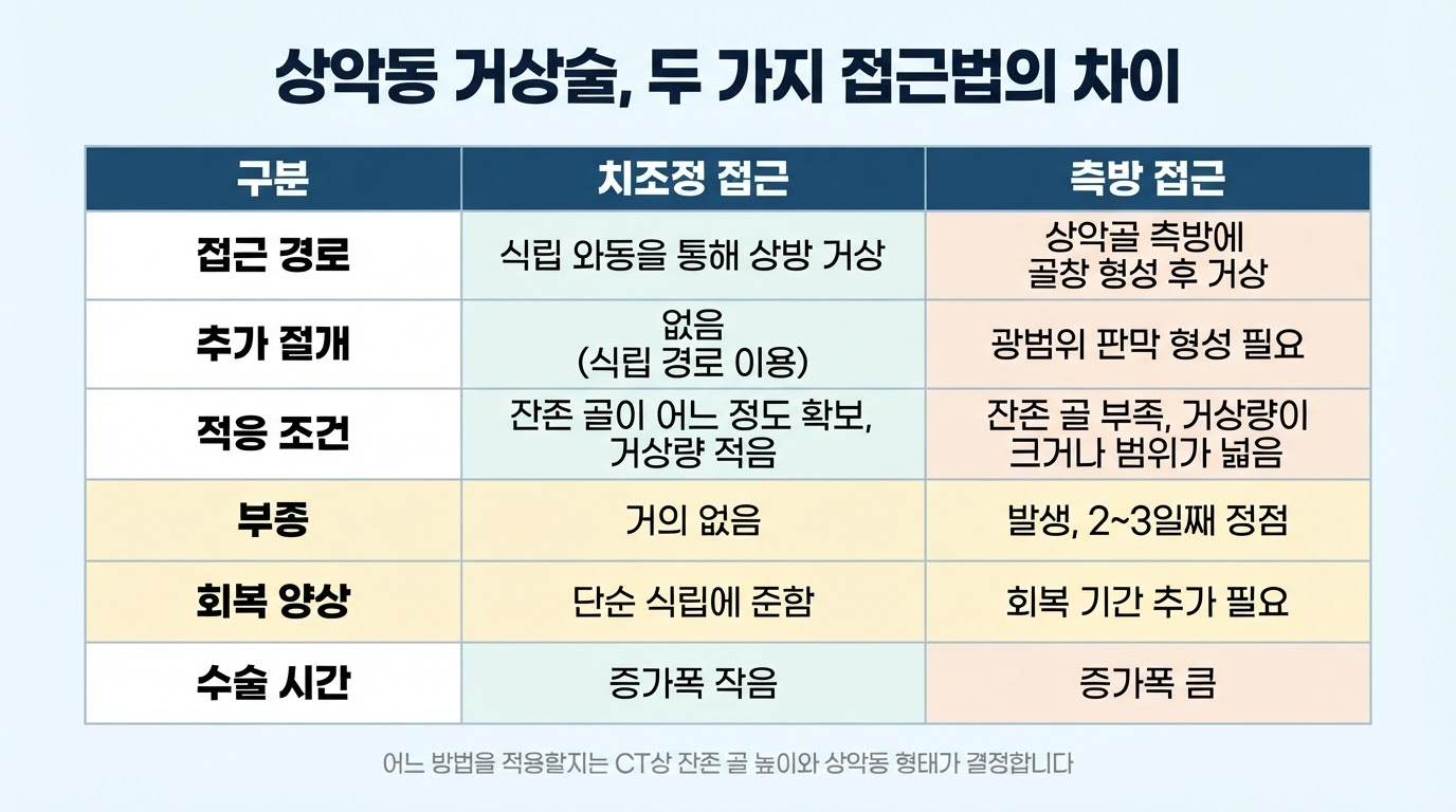 치조정접근법과 측방접근법의 차이