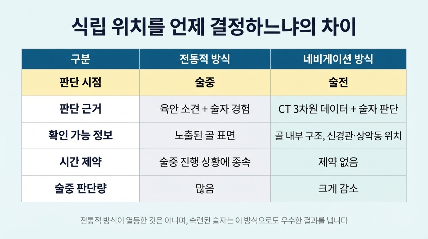네비게이션 임플란트란 — 사전 설계가 바꾸는 것